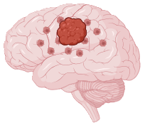 GlioLighT Project - brain-transparent